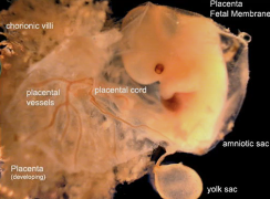 Human_Yolk_Sac